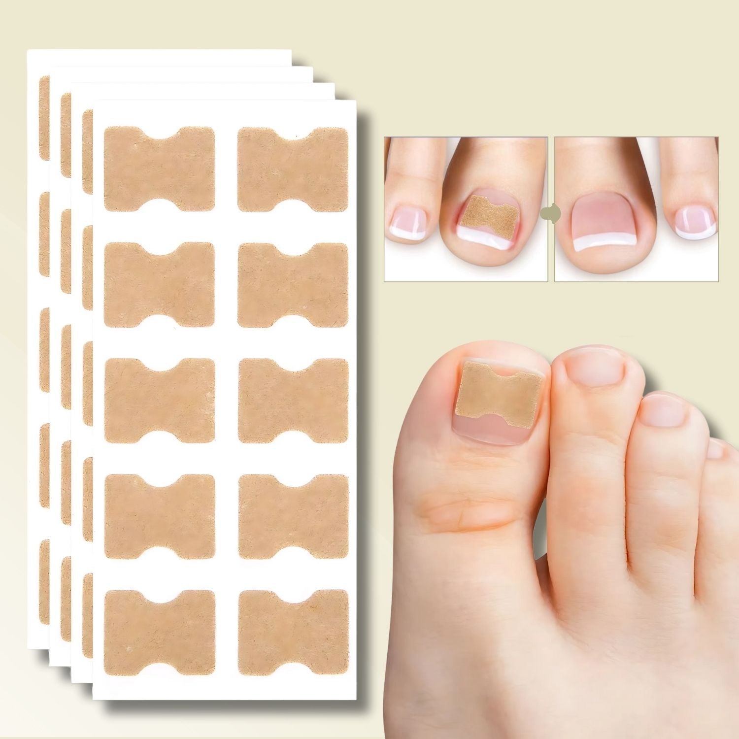 10+10 GRATIS | FixaNail - Sofortige Nagelreparatur