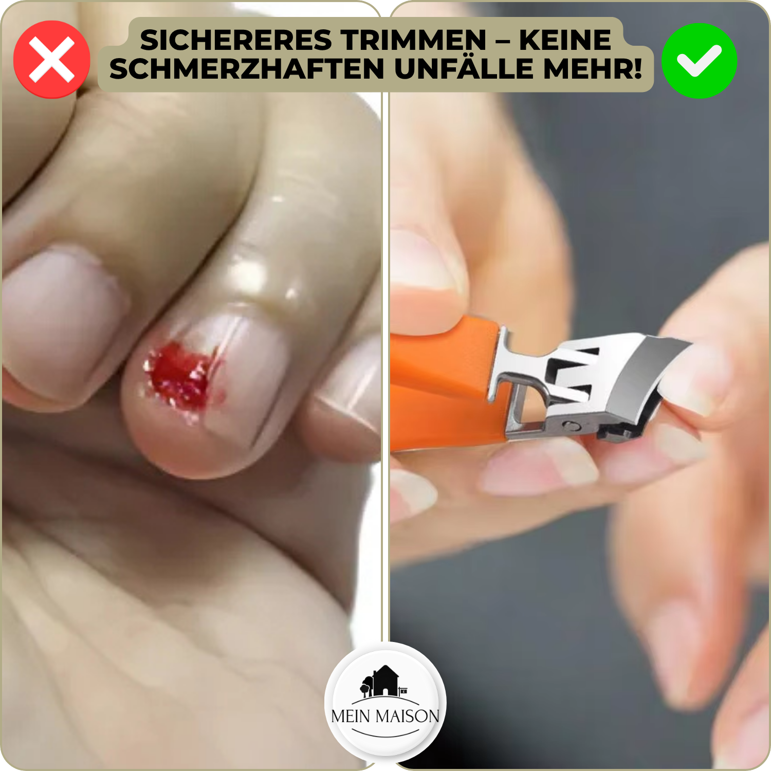 Nagelknipser WideTrim | Extra Breite Schneideöffnung | Anti-Spritz Design | Rostfreier Stahl
